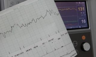 老年人心衰早期症状 心衰的6个早期信号